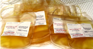 Frozen Plasma. Image courtesy of Medicoinfo.